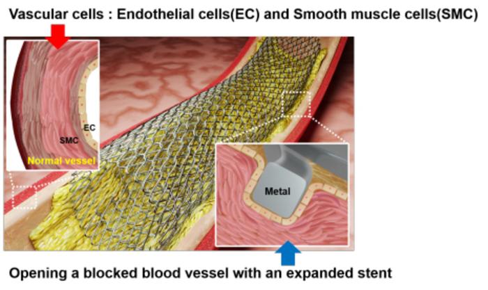 Image: Expanded stent physically opens a blocked blood vessel (Photo courtesy of KIST)